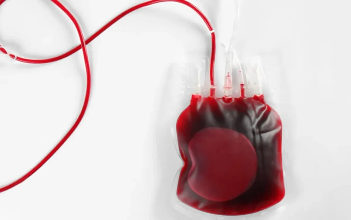 Transfusão de sangue, Transfusões, Transfusão de sangue alheio;